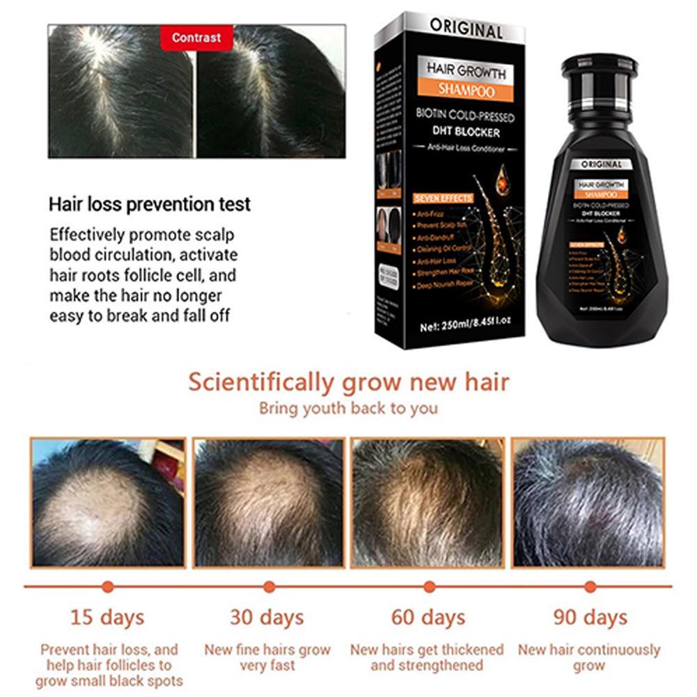 Biotin Zencefil Şampuanı Yoğun - Biotin Shampoo Thickening incelemesi ve fiyatı